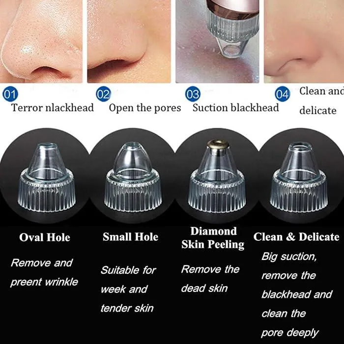 Blackhead Remover Acne Pimple Pore Vacuum Cleaner XN-8030